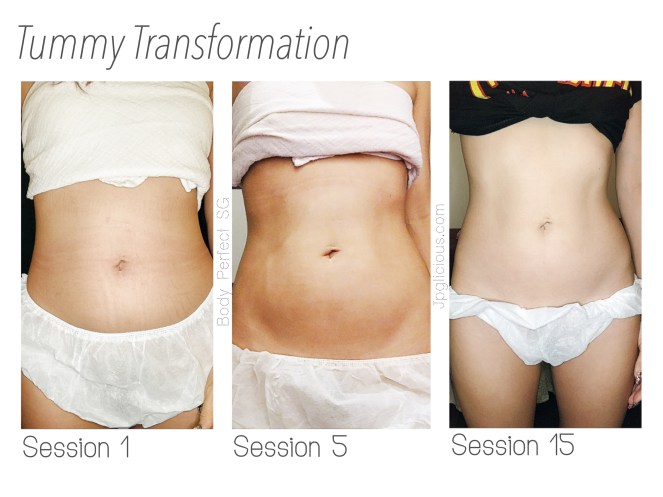 Body Perfect SG Slimming Weight Loss Singapore - Jpglicious Mar 2017 (2)