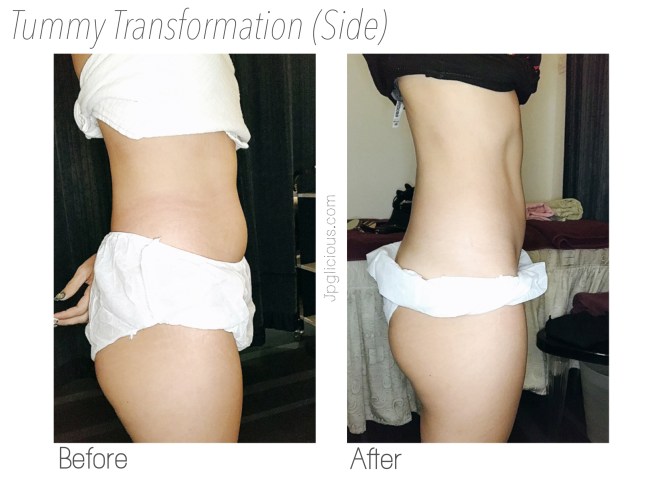 Body Perfect SG Slimming Weight Loss Singapore - Jpglicious Mar 2017 (4)