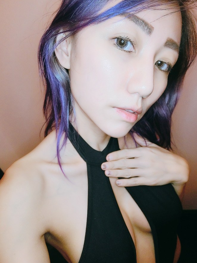 Allure Plastic Surgery Singapore - Breast Augmentation Mentor - Dr Samuel Ho (15)