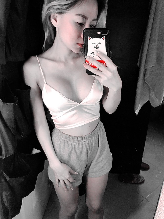 Allure Plastic Surgery Singapore - Breast Augmentation Mentor - Dr Samuel Ho (18)