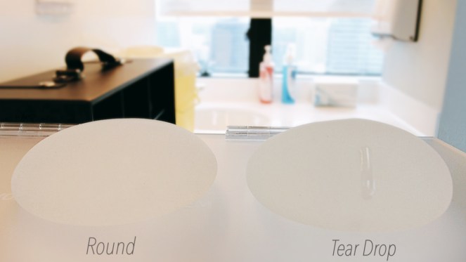 Allure Plastic Surgery Singapore - Breast Augmentation Mentor Impants- Dr Samuel Ho (10)