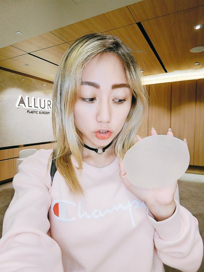 Allure Plastic Surgery Singapore - Breast Augmentation Mentor Impants- Dr Samuel Ho (6)