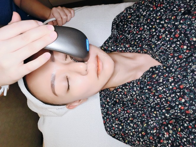 SygmaLift V Contourae Face - Kowayo Aesthetic Clinic Singapore - Jpglicious (6)